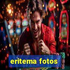 eritema fotos